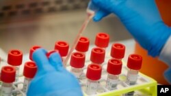 A technician prepares COVID-19 coronavirus patient samples for testing at a laboratory in New York's Long Island. Wide scale testing is a critical part of tracking and containing infectious…