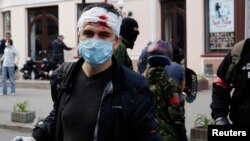 An injured pro-Russian activist looks on during clashes with supporters of the Kyiv government in the streets of Odessa, Ukriane, May 2, 2014. 